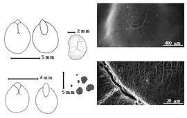  Seed, cotyledon, embryo, and testa:  P. globosum  (Gillies) A.E. Burkart - bottom far left cotyledons concealing all but radicle tip (L) and embryonic axis (R);  P. mexicanum  (Dressler) A.E. Burkart - top left center seed topography, top far left cotyledons concealing all but radicle tip (L) and embryonic axis (R), testa SEMs;  P.  spp. - bottom left center seeds.
