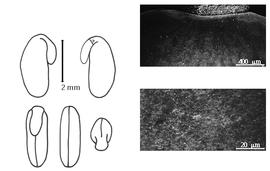  Cotyledon, embryo, and testa:  P. aphylla  C. Linnaeus - testa SEMs;  P. pinnata  C. Linnaeus - embryo and cotyledons.
