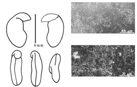  Cotyledon, embryo, and testa:  R. sphaerocarpa  (C. Linnaeus) P.E. Boissier - embryo, cotyledons, and testa SEMs.
