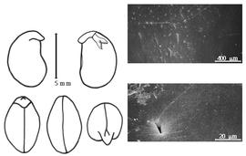  Cotyledon, embryo, and testa:  R. phaseoloides  (O.P. Swartz) A.P. de Candolle - embryo, cotyledons, and testa SEMs.
