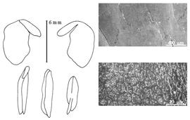  Cotyledon, embryo, and testa:  S. madagascariensis  R. Viguier - embryo, cotyledons, and testa SEMs.
