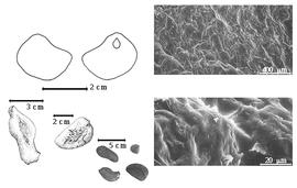  Seed, cotyledon, embryo, and testa:  S. asoca  (W. Roxburgh) E.A.J. De Wildeman - top left cotyledon entire above radicle (L) and embryonic axis (R):  S. declinata  (J.G. Jack) F.A.W. Miquel - bottom left center seed topography;  S. indica  C. Linnaeus - testa SEMs;  S. thaipinsensis  Cantley ex King - bottom far left seed topography;  S.  spp. - bottom center seeds.
