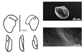  Cotyledon, embryo, and testa:  S. purpurea  W.J. Hooker - embryo, cotyledons, and testa SEMs.
