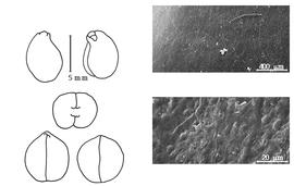  Cotyledon, embryo, and testa:  S. tomentosa  C. Linnaeus - embryo, cotyledons, and testa SEMs.
