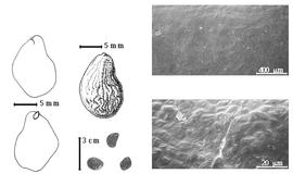  Seed, cotyledon, embryo, and testa:  S. micranthus  H.A.T. Harms - far left cotyledon notched and concealing all but tip of radicle (above) and embryonic axis (below), top left center seed topography, bottom left center seeds, testa SEMs.
