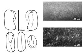  Cotyledon, embryo, and testa:  T. purpurea  (C. Linnaeus) C.H. Persoon - embryo, cotyledons, and testa SEMs.
