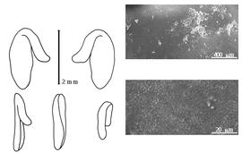  Cotyledon, embryo, and testa:  U. capitatus  P.K.N.S. Turczaninow - embryo, cotyledons, and testa SEMs.
