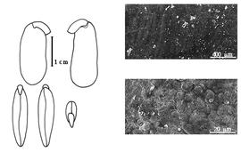  Cotyledon, embryo, and testa:  V. speciosa  W.A. Ducke - embryo, cotyledons, and testa SEMs.
