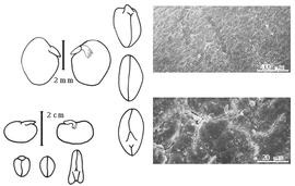  Cotyledon, embryo, and testa:  V. faba  C. Linnaeus - bottom left embryo, cotyledons, and testa SEMs;  V. sativa  C. Linnaeus - top left embryo and cotyledons.
