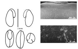  Cotyledon, embryo, and testa:  V. juncea  (H.A. Schader) J.C. von Hoffmannsegg - embryo, cotyledons, and testa SEMs.
