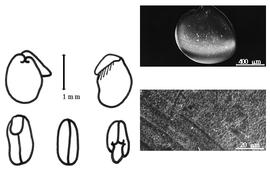  Cotyledon, embryo, and testa:  Z. glochidiata  H.G.L. Reichenbach ex A.P. de Candolle - embryo, cotyledons, and testa SEMs.
