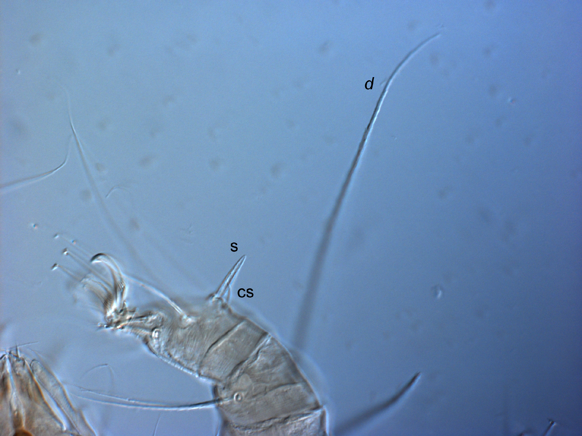 Fig. 5. Raoiella bauchani adult female leg I ( d = dorsal seta on tibia I, s = solenidion, cs = companion seta).