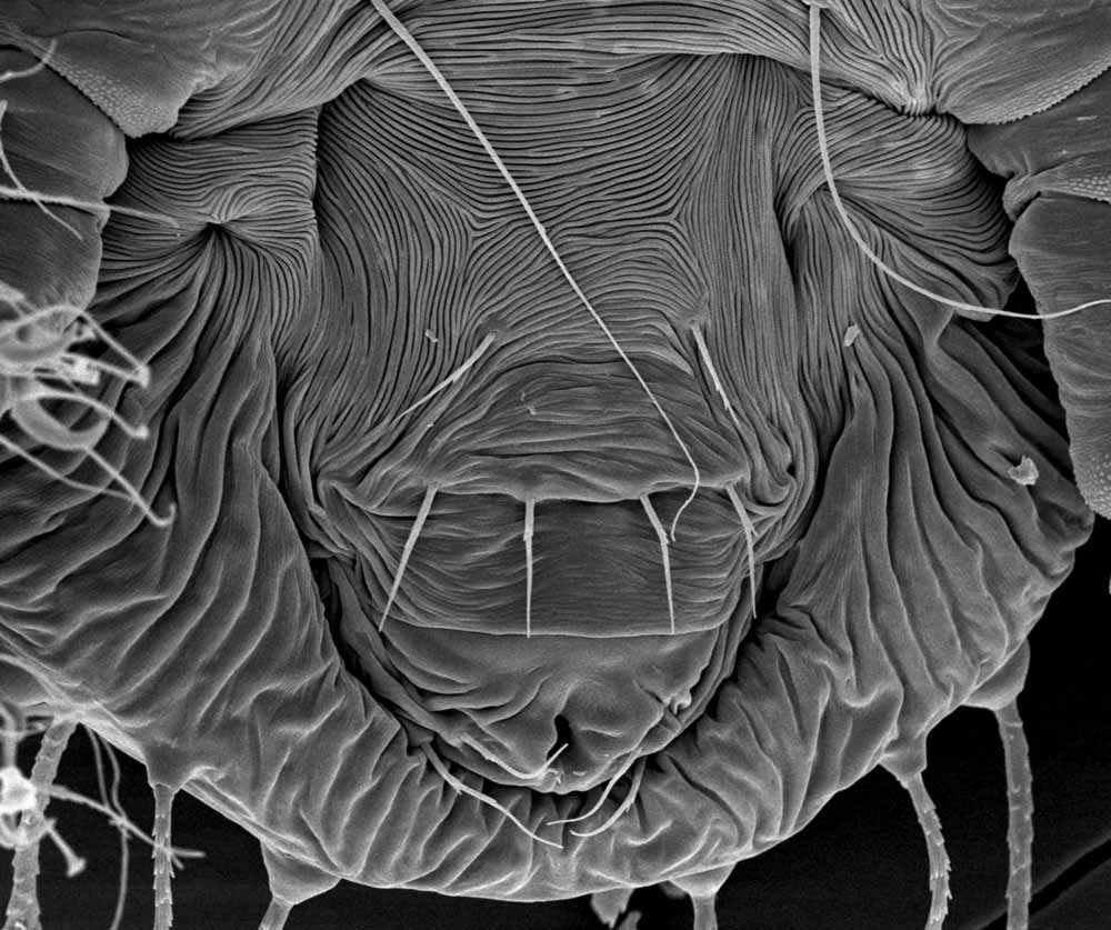 Fig. 7. Raoiella bauchani , female posterior venter, with detail of genital region (image: Gary Bauchan, USDA-ARS).
