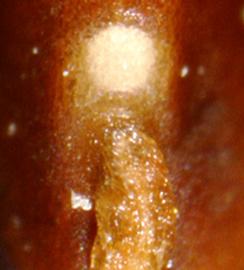  lens and funiculus remnant of seed 