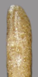  hilum of seed 