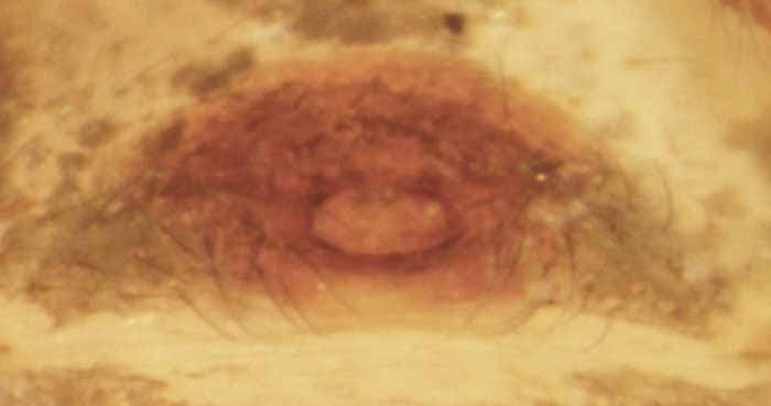            female genitalia; epigynum   