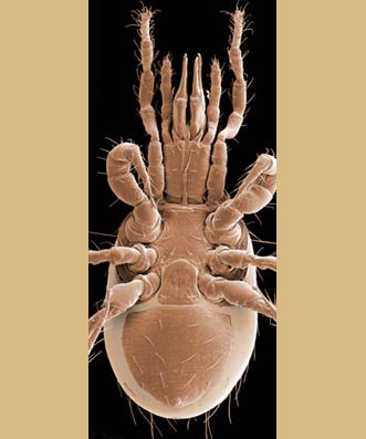 Figure 6; Athiasella female venter