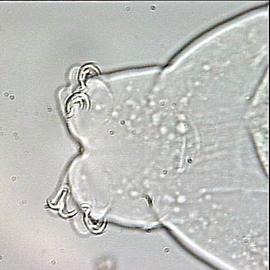  Macrobiotus  sp. terminal claws (HCP)