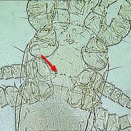 Digamasellidae ( Digamasellus ) usually have 3–4 scleronoduli