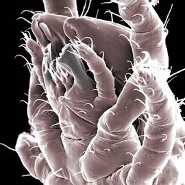  Parhypochthonius  (DEW)