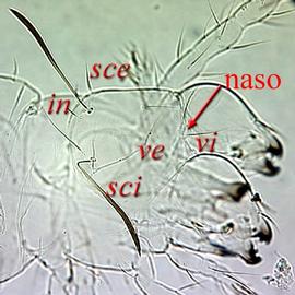  Adephacarus  prodorsum (HCP, DEW)