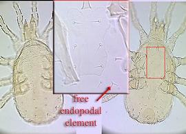  Arctoseius  sp. female