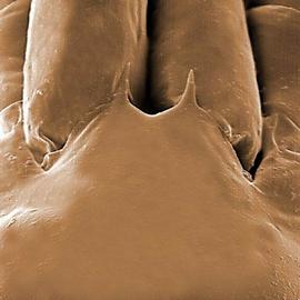  Asca  bifurcate tectum