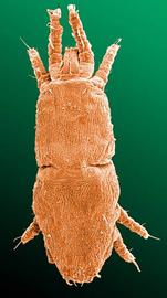   Dolichotetranychus  female dorsum
