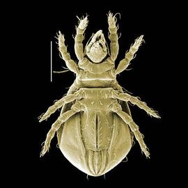  Eniochthonius  venter (DEW)