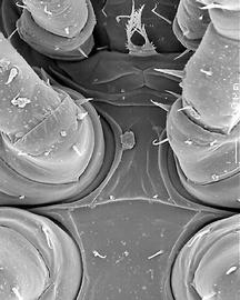   Evimirus  sternal region (DEW)
