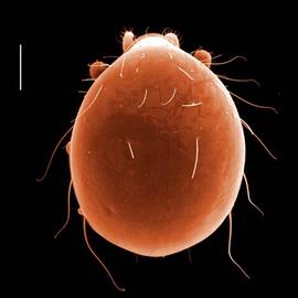 Beetle-like all encompassing armor;  Gamasiphis  dorsal (DEW)