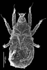 Histiostomatidae venter (DEW)