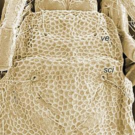 Two pairs of prodorsal trichobothria (DEW)
