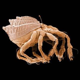Oribatid mite with scalps (DEW)