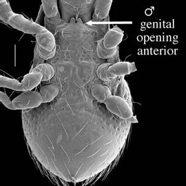  Pergamasus  male venter (DEW)