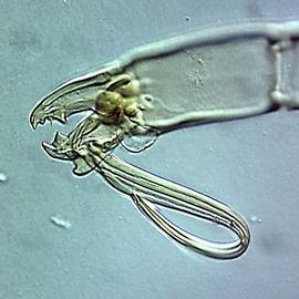   Pachylaelaps  male chelicera (DEW)
