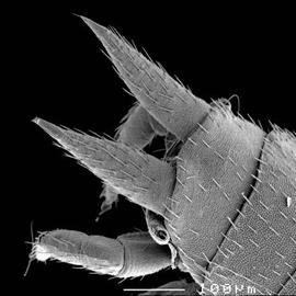 Distal abdominal cerci of symphylan (DEW)