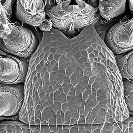   Asternolaelaps  genital (Sejida)
