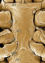  Veigaia  sternogenital region (DEW)