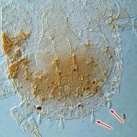  Zercoseius  posterior dorsal shield over ventrianal shield 
 