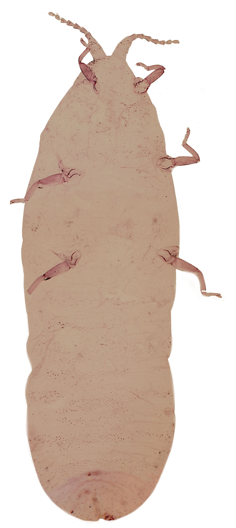  Matsucoccidae:  Matsucoccus  sp. 