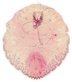  Diaspididae:  Parlatoria pergandii   