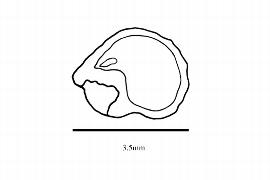  Embryo:  Dillenia suffruticosa ; Illustration by K. Parker, Kirkbride et al. (2006)
