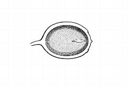  Embryo:  Phthirusa nitens ; Illustration by K. Parker, Kirkbride et al. (2006)
