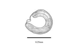  Embryo:  Mollugo pentaphyll a; Illustration by K. Parker, Kirkbride et al. (2006)
