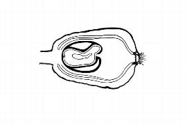  Embryo:  Leptolaena multiflora ; Illustration by K. Parker, Kirkbride et al. (2006)
