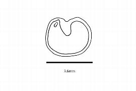  Embryo:  Kadsura japonica ; Illustration by K. Parker, Kirkbride et al. (2006)
