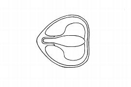   Embryo:   Hedychium gardnerianum ; Illustration by K. Parker, Kirkbride et al. (2006) 
