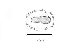   Embryo:   Mitracarpus scaber ; Illustration by K. Parker, Kirkbride et al. (2006)
