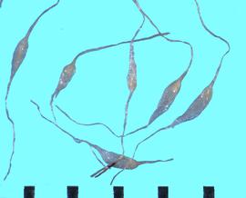  Dendrobium  sp. Full seeds with appendages on both ends.